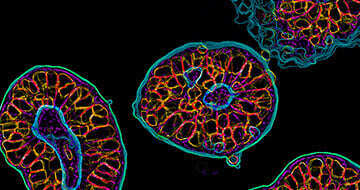 Organoids-for-Oncology-Drug-Discovery