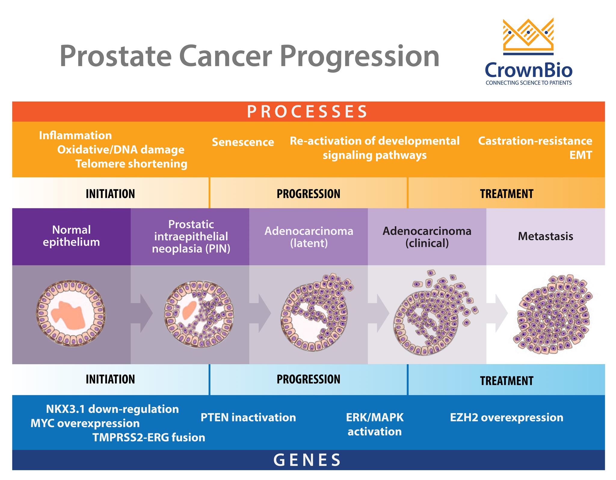 Why Are Prostate Cancer Preclinical Models Hard To Develop 